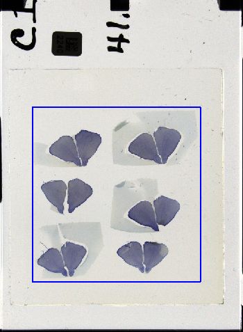 Media type: image; Special Collections 3298   shows specimen_part histological serial section;